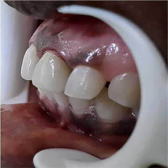 BnA 1b